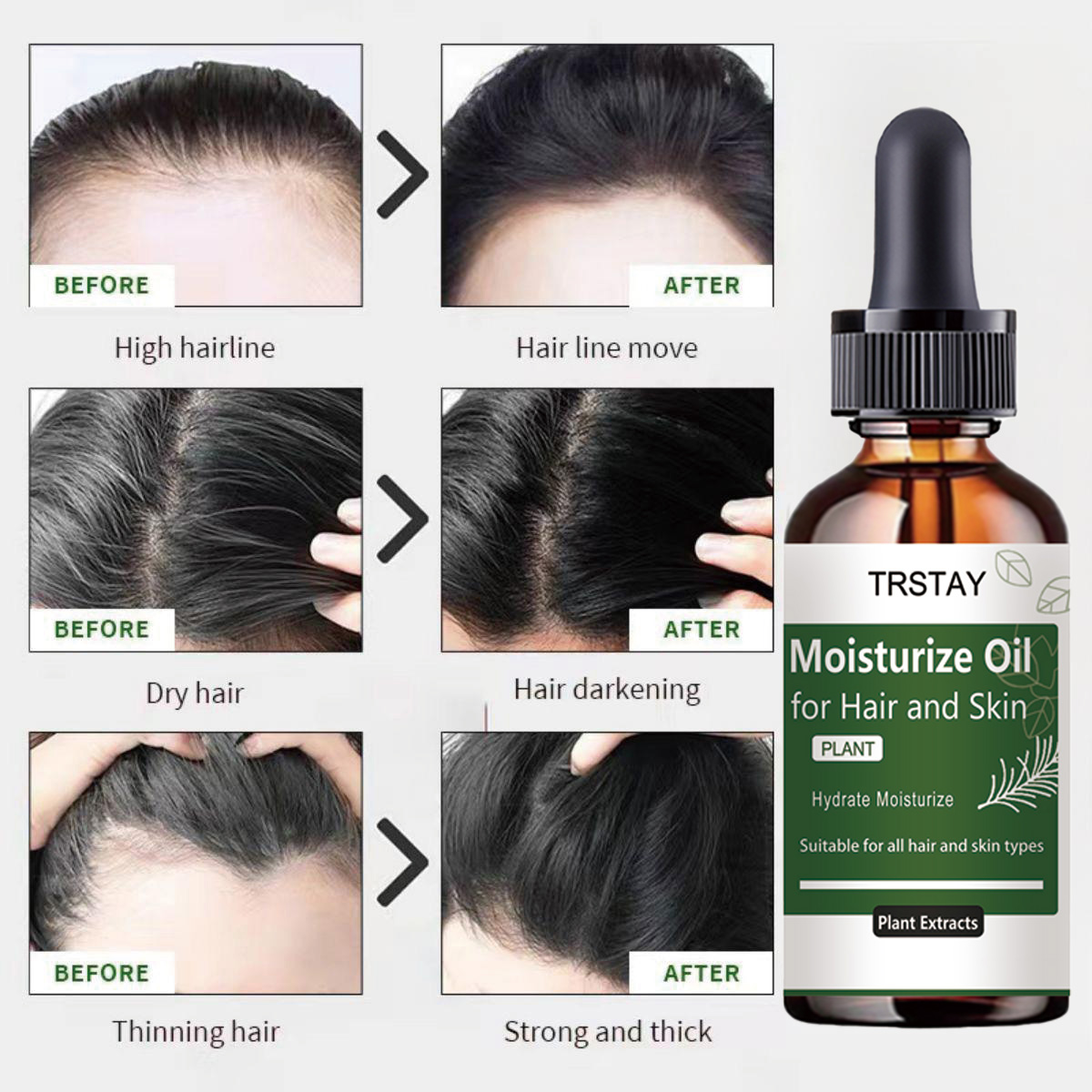 TRSTAY Aceite esencial de rome - Rosemary Hair Oil reseña y precio